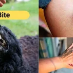 रेबीज़ की चपेट में : देहरादून व हरिद्वार में दो युवकों की दर्दनाक मौत